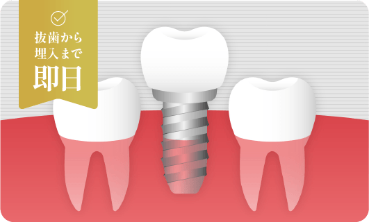 抜歯即時インプラントの画像