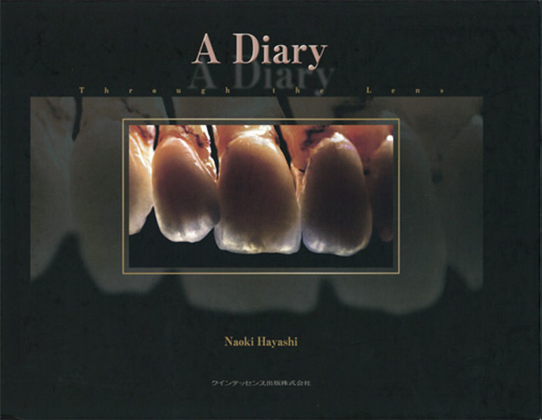 (SALE)   A diary    林直樹　著　歯科技工