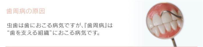 歯周病の原因　むし歯は歯におこる病気ですが、『歯周病』は“歯を支える組織”におこる病気です。