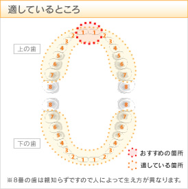 オールセラミック：適しているところ