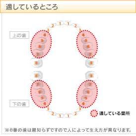 ホワイトセラミック：適しているところ