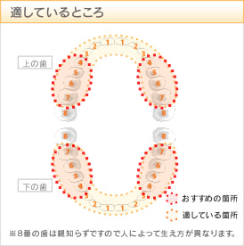 ゴールド または プラチナ：適しているところ